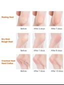 Silikon Topuk Nemlendirici Çorap - 2