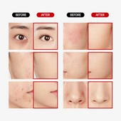 Merythod Dual Concealer 01 Pure Ivory - Çift Uçlu Kapatıcı (Stick ve Likit) - 10