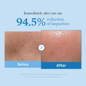 medicube - Zero Pore Blackhead Deep Cleansing Oil (Siyah Nokta Giderici Derin Temizleyici Yağ)(GLOBALCARE) - 4