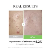 medicube - Exosome Cica Ampoule(Aydınlatıcı Serum) thumbnail 5