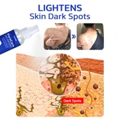 Porecare Cilt Bakım Spreyi - Siğil, Ben ve Nasır Giderici - 60ml - 3