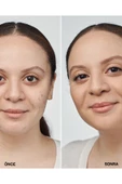 CLİNİQUE Even Better Clinical™ Serum Fondöten Spf 20 - Renk: Cn 52 Neutral (MF) - 30ml - 2