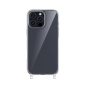 Apple iPhone 16 Pro Kılıf Zore X-Rop Kapak - 9