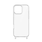 Apple iPhone 16 Pro Kılıf Zore X-Rop Kapak - 3