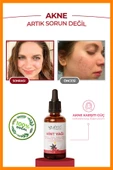 Hint Yağı Vücut, Saç, Kaş Kirpik Ve Tırnak Bakım Yağı, Soğuk Sıkım %100 Saf 30 ml - 4