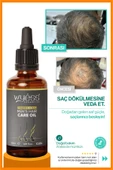 Erkek Saç Bakım Yağı - Dökülme Karşıtı, Saç Çıkarıcı & Besleyici Etki, E & A Vitaminli 50 ml - 3