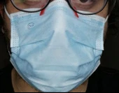 Byr Cerrahi Maske İçin Buğu Önleyici Klip (Plastik Aparattır!!!) 3D thumbnail 2