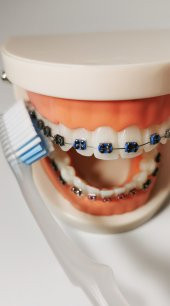 Pearldent Ortho - Ortodontik Diş Fırçası (Kapaklı) - 3