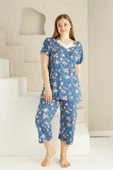 Anne Kalıp Tunik Büyük Beden Kapri-Battal Beden Dantel Detay Kısa Kol Viskon Bermuda Pijama Takımı - 5