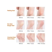 Silikon Topuk Nemlendirici Çorap - 2