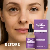 Garlex yaşlanma karşıtı göz çevresi bakım serumu,30 ml - 2