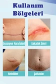 Silikon Yara Jeli  Keloid, Ameliyat, Yanık Ve Yaralanma Izleri Için Tıbbi Kalitede Jel - 2