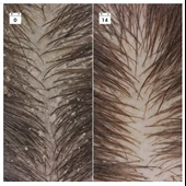 SEPHORA COLLECTION Kepek Karşıtı Nüks Önleyici Serum - Saç Serumu thumbnail 2