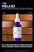 Mela B3 Koyu Leke Karşıtı Serum 30ml - 8