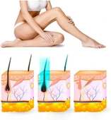 Yui IPLV15 Pro Vücut -Yüz- Bikini Başlıklı Ağrısız Otomatik ve Manuel Atım Buz Lazer Epilasyon Cihazı - 3