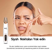 Beauty Vogue Vakumlu Siyah Nokta-akne-sivilce-clean Yüz-cilt Temizleme Bakım Cih thumbnail 2
