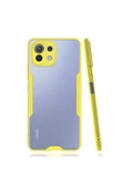 Nettech  Xiaomi Mi 11 Lite Uyumlu Platin Seri Arka Koruma Kılıf - Sarı - 1