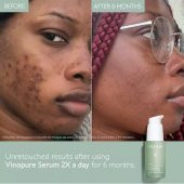 Caudalie Vinopure Serum 30 ml - 4