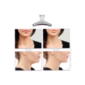 Kırışıklık Giderici Masaj Cihazı thumbnail 3