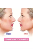 Ayarlanabilir V-Şekilli Yüz Kaldırma Bandı (Unisex) – Çift Çene Azaltıcı, Nazolabiyal Kırışıklık Sıkılaştırıcı, Nefes Alabilen & Kokusuz, Hipoalerjenik Kumaş, thumbnail 2
