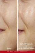 L'Oreal Paris Revitalift Parlak&pürüzsüz, Koyu Leke Karşıtı Peeling Etkili Tonik, %5 Saf Glikolik As - 5
