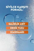 NIVEA Derma Skin Clear Sivilce Karşıtı Yüz Temizleyici Peeling 150ml, Salisilik Asit,Niasinamid,Deniz Tuzu - 3