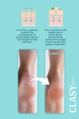 Clasy Care Ayak Ve Topuk Çatlak Kremi, Ayak Bakımı, Ayak Kokusu Ve Topuk 100ml - 4
