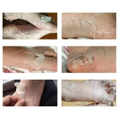 Sunup SN-26965 Ayak Peeling Maskesi (Nasır, Ölü Deri, Egzama Giderici) - 4
