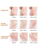 Silikon Topuk Nemlendirici Çorap - 7