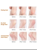 Silikon Topuk Nemlendirici Çorap - 2