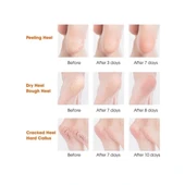 Silikon Topuk Nemlendirici Çorap - 4