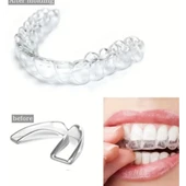 515 Bruksizm Gece Aparatı Plağı - 1