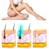 Yui IPLV15 Pro Vücut -Yüz- Bikini Başlıklı Ağrısız Otomatik ve Manuel Atım Buz Lazer Epilasyon Cihazı - 4