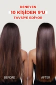 Zigavus Forte Yağlı Saçlar Için Saç Dökülmesine Karşı Şampuan 3 Adet Ve Dökülme Karşıtı Serum - 7