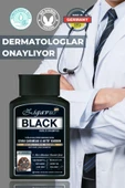 Zigavus Black - Siyah (Kara) Sarımsaklı - Aktif Karbonlu Şampuan 300 ml 3 Al 2 Öde 8699349130763 - 7