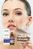 Elose Rosemary Oil Çay Ağacı Yağı Akne ve Siyah Nokta Cilt Bakım Serumu 50 ml. - 5