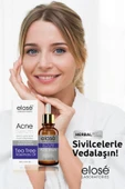 Elose Rosemary Oil Çay Ağacı Yağı Akne ve Siyah Nokta Cilt Bakım Serumu 50 ml. - 4