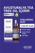 Elose Rosemary Oil Çay Ağacı Yağı Akne ve Siyah Nokta Cilt Bakım Serumu 50 ml. - 2