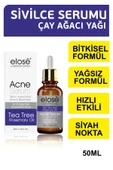 Elose Rosemary Oil Çay Ağacı Yağı Akne ve Siyah Nokta Cilt Bakım Serumu 50 ml. - 1