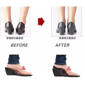 Esnek Düz Taban Düzeltici Topuk Yastığı 1 Çift thumbnail 4