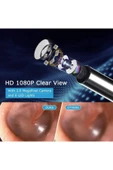 harry Kablosuz Hd Kameralı Kulak Temizleme Seti 360° açı 1296P Wifi Bağlantılı IOS ve Android Uyumlu thumbnail 6