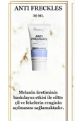 Homm Life Bitkisel HOMM LIFE ANTI FRECKLES LEKE KREMİ 30 ML - 1