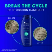 Head&Shoulders Clinical Strength Cooling Itch Relief 2in1 Şampuan 400 ML thumbnail 4