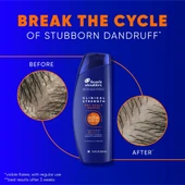Head&Shoulders Clinical Strength Dry Scalp Rescue Şampuan 400 ML - 4