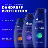 Head&Shoulders Clinical Strength Dry Scalp Rescue Şampuan 400 ML - 7