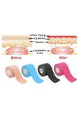 FİZYOPOL FİZYOPOL New Product Kinezyo Tape Band 5 Metre X 5 Cm Mor Renk Kinesio Sporcu Bandı thumbnail 7