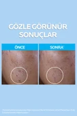 LA ROCHE POSAY Effaclar Temizleme Jeli 400ml Yağlı Ve Akneye Eğilim Gösteren Ciltler - 4
