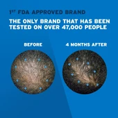 Rogaine Men's 5% Minoxidil Topical Aerosol Hair Regrowth Treatment Foam, 3 Month Supply Each Can 2.11 Ounce 60 Gram - 2