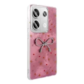 Xiaomi Redmi Note 13 Pro 4G Kılıf Kamera Korumalı Figürlü Zore Ponti Silikon Kapak - 2