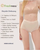Freshness 0025 Lazer Kesim Tül Yüksek Bel Bato Korse - 1